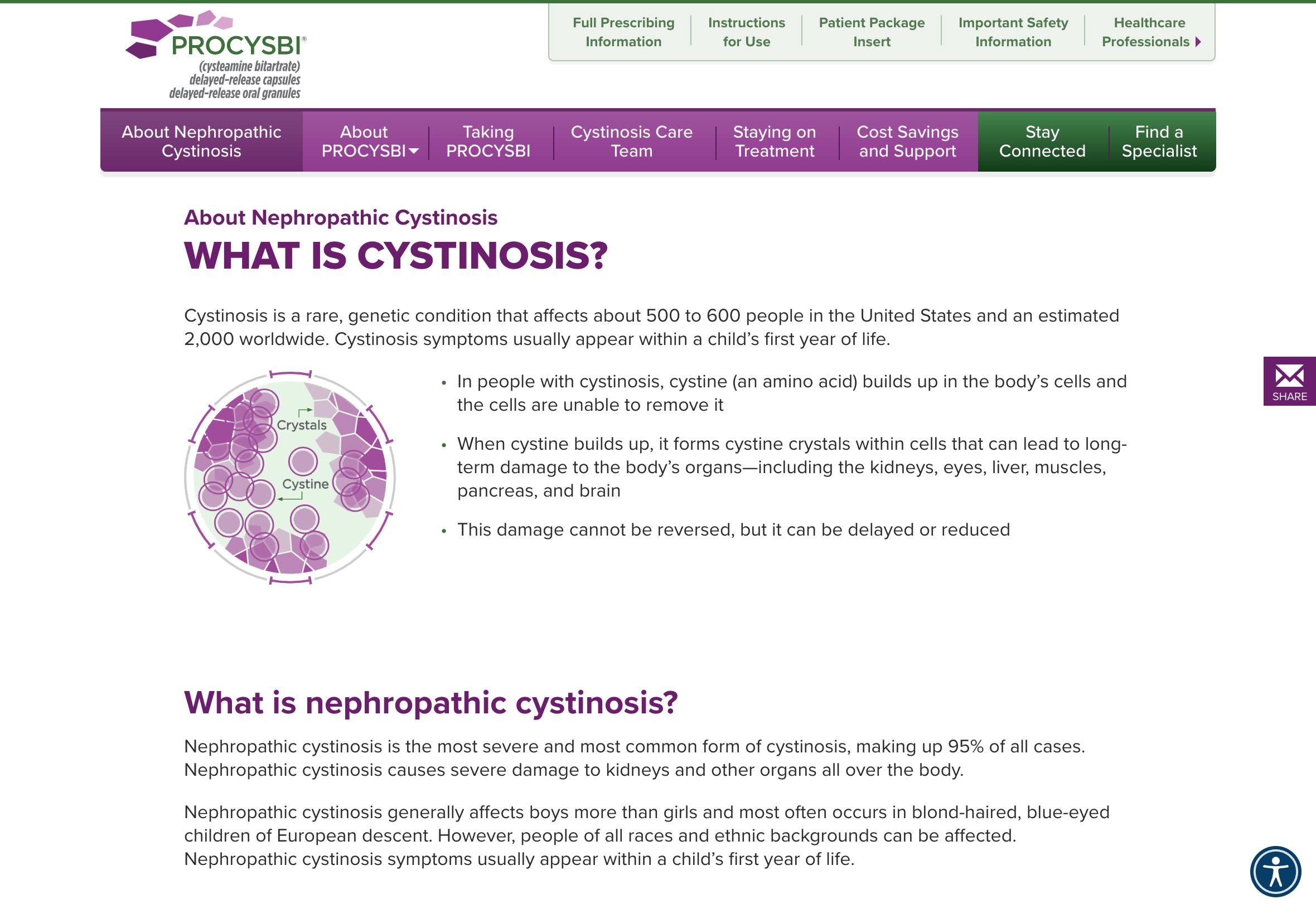 Nephropathic-Cystinosis-Symptoms-Tests-and-Management-PROCYSBI®-cysteamine-bitartrate-
