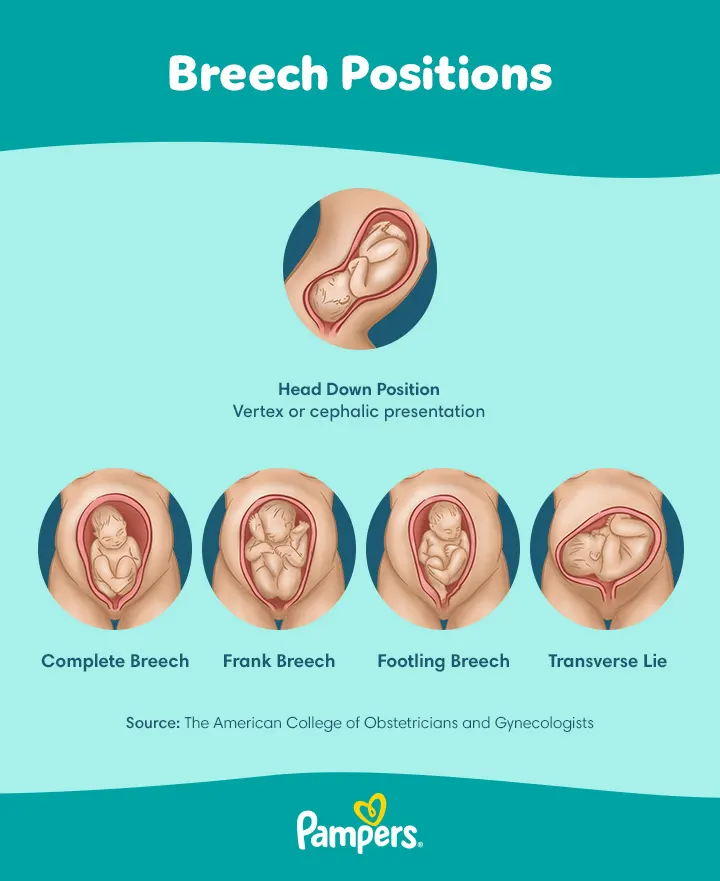 Birth positions