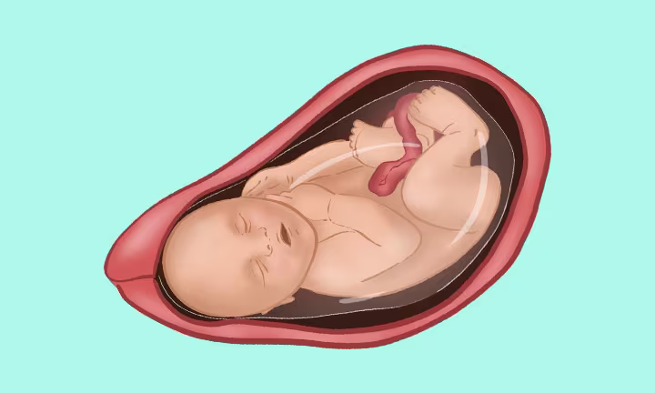 Lage des Babys in der 40. SSW