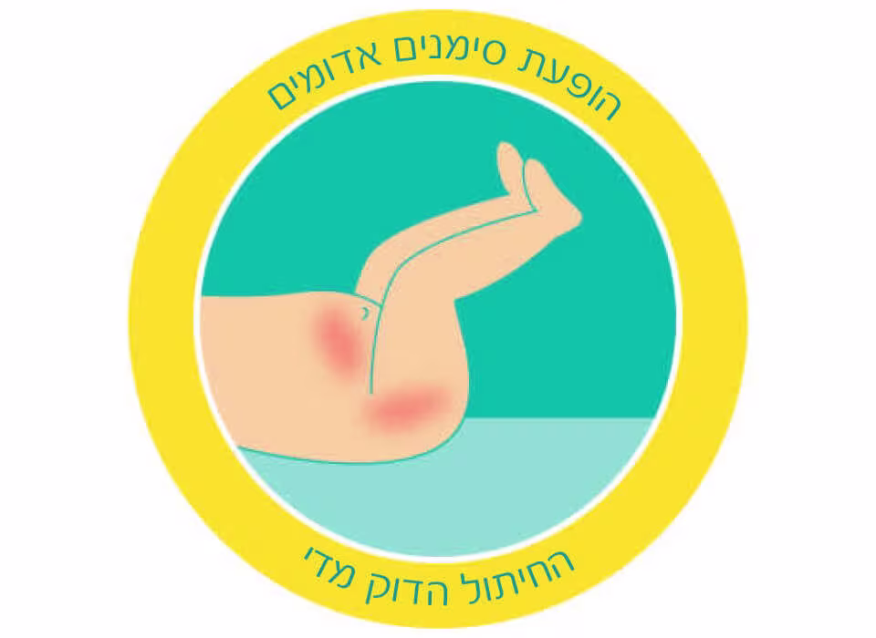 חיתולים לתינוקות