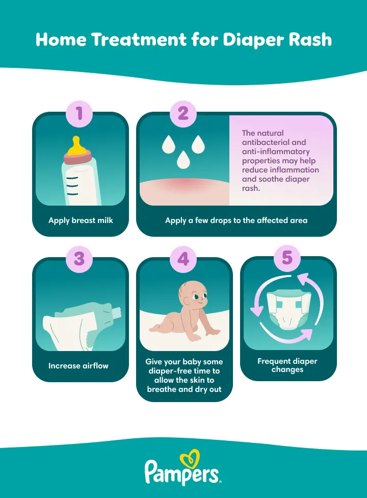 Infographic: Home remedies for treating Diaper rash