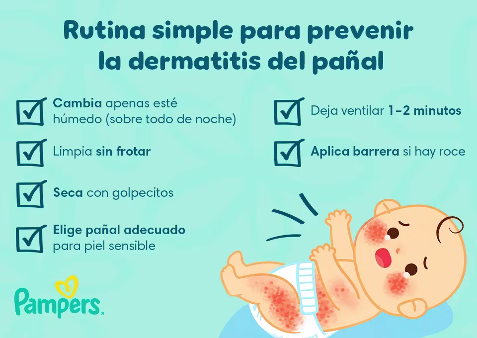 Rutina simple para prevenir la dermatitis del pañal Irritación y dermatitis del pañal