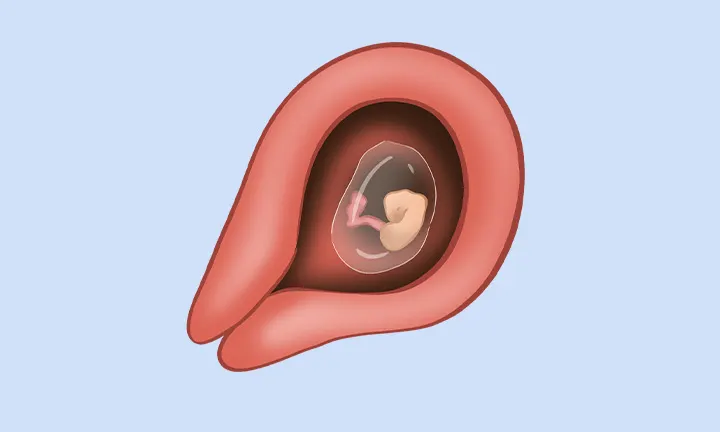 Cómo es un embrión de 5 semanas Cómo es un embrión de 5 semanas