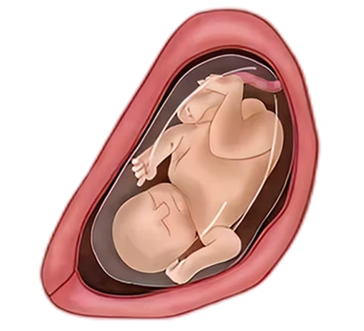 Illustration of a fetus inside a womb during the 8th month of pregnancy, showing its development and position. Illustration of a fetus inside a womb during the 8th month of pregnancy, showing its development and position.