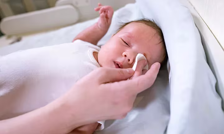 Bindehautentzündung bei Babys