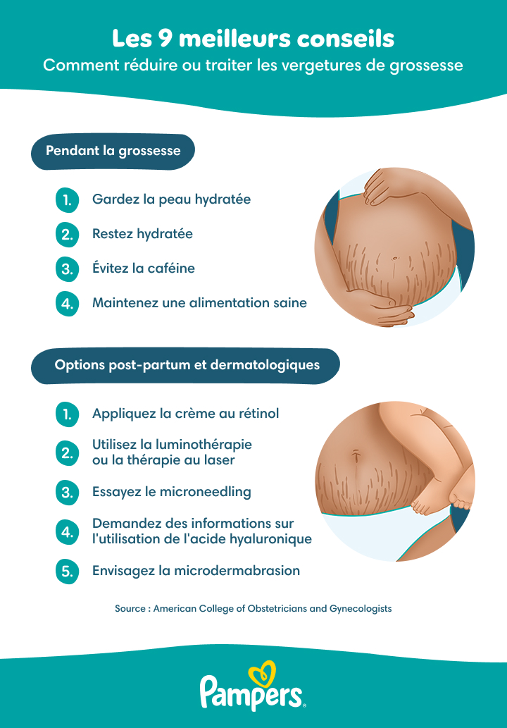 Pr-clampsie : dfinition, symptmes, traitement | Pampers
