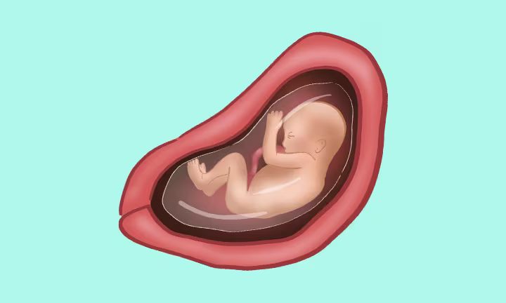 Lage des Babys in der 26. SSW