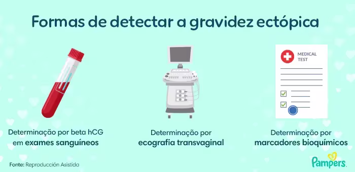 gravidez ectópica