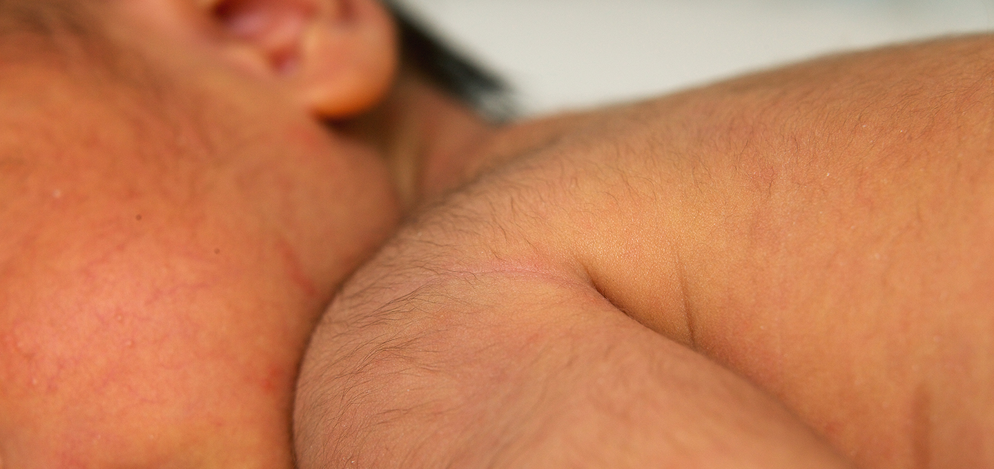 Nahaufnahme von Babyhaut mit feinem Lanugo-Haar an Schulter und Nacken, zeigt natürliche Behaarung bei Neugeborenen.]