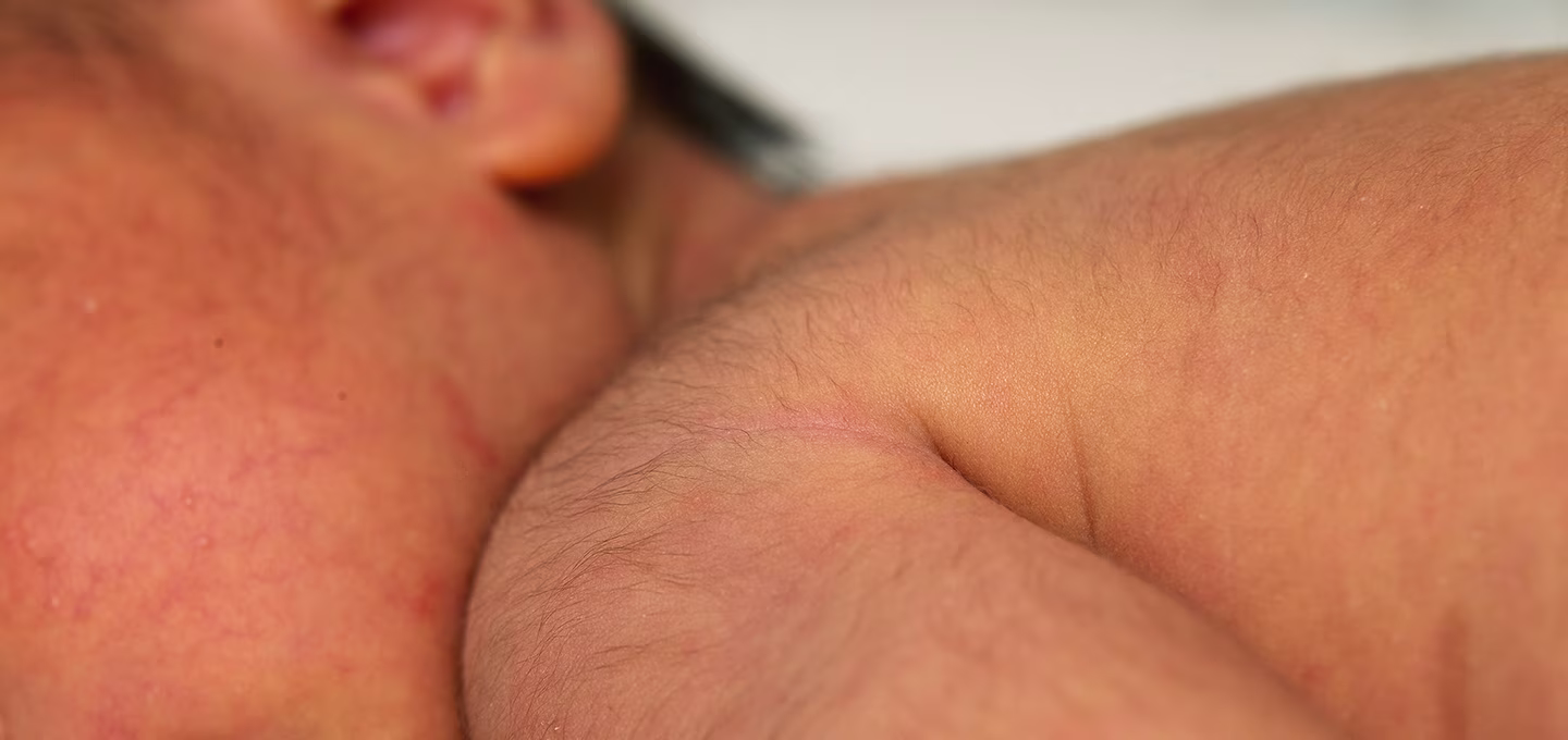 Nahaufnahme von Babyhaut mit feinem Lanugo-Haar an Schulter und Nacken, zeigt natürliche Behaarung bei Neugeborenen.]