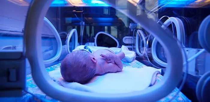 Bebé prematuro en incubadora Bebé prematuro en incubadora