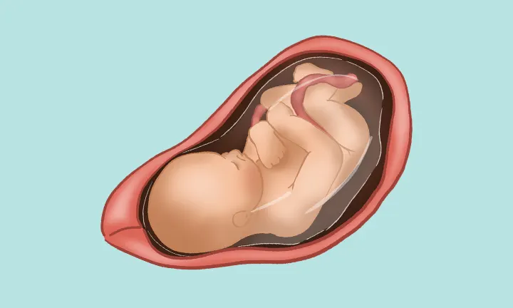 Lage des Babys in der 36. SSW