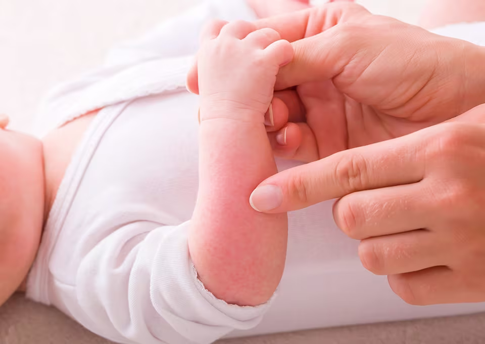 Mamá toca a su bebé. Alergia en bebés.