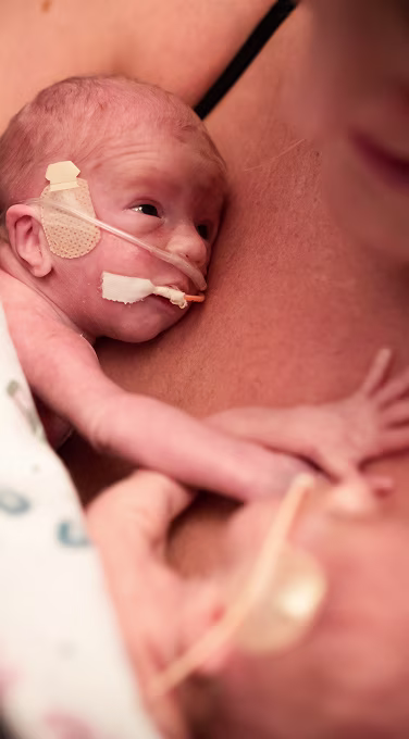Close up of NICU twins laying on mom's chest