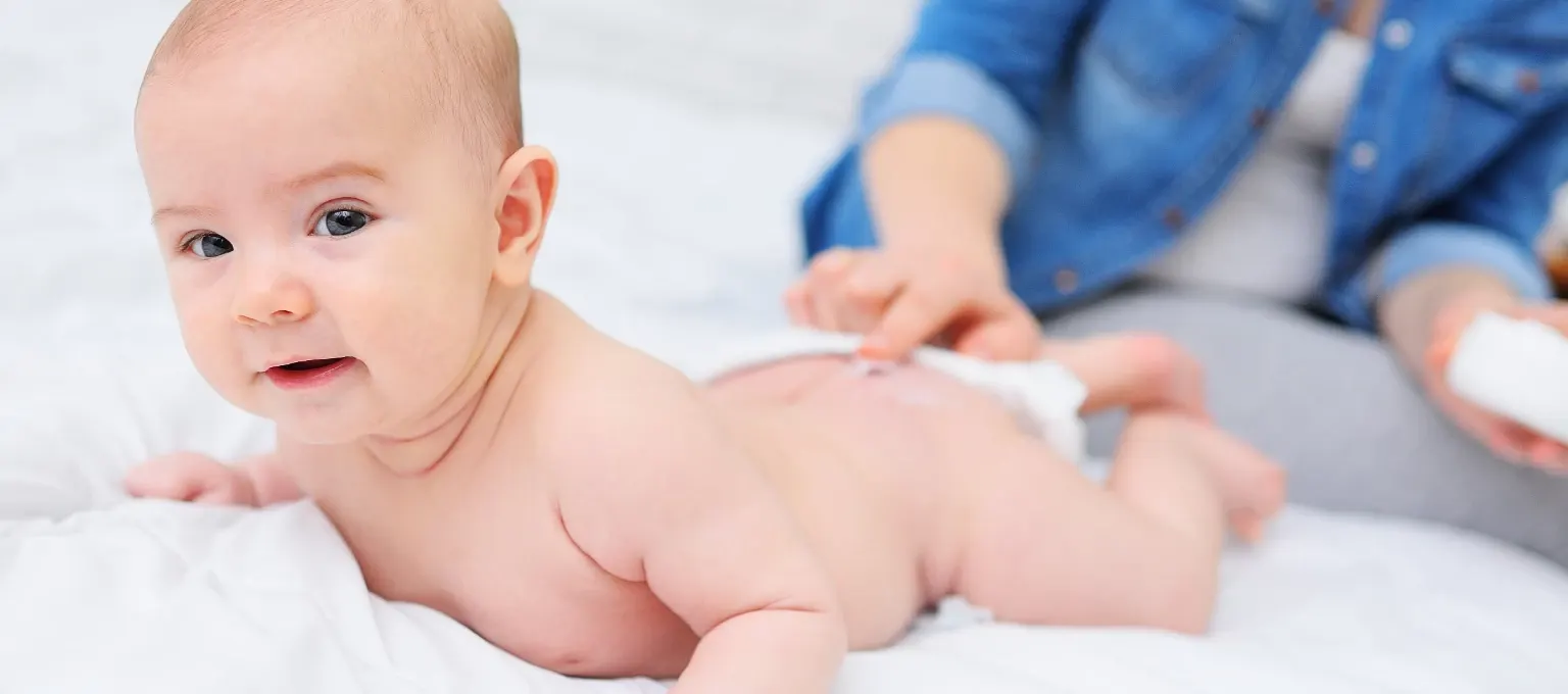 Bebé con dermatitis del pañal