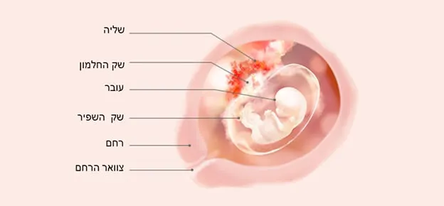 התפתחות העובר לפי שבועות-Article Content Image week10 10