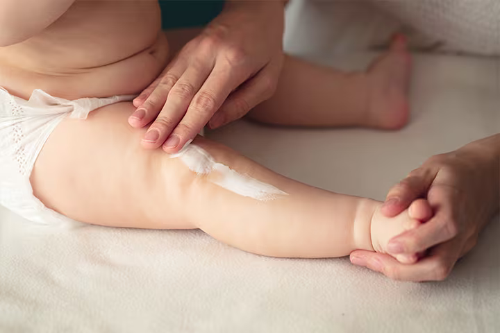 Cele mai frecvente tipuri de erupții cutanate la nou-născuți și bebeluși