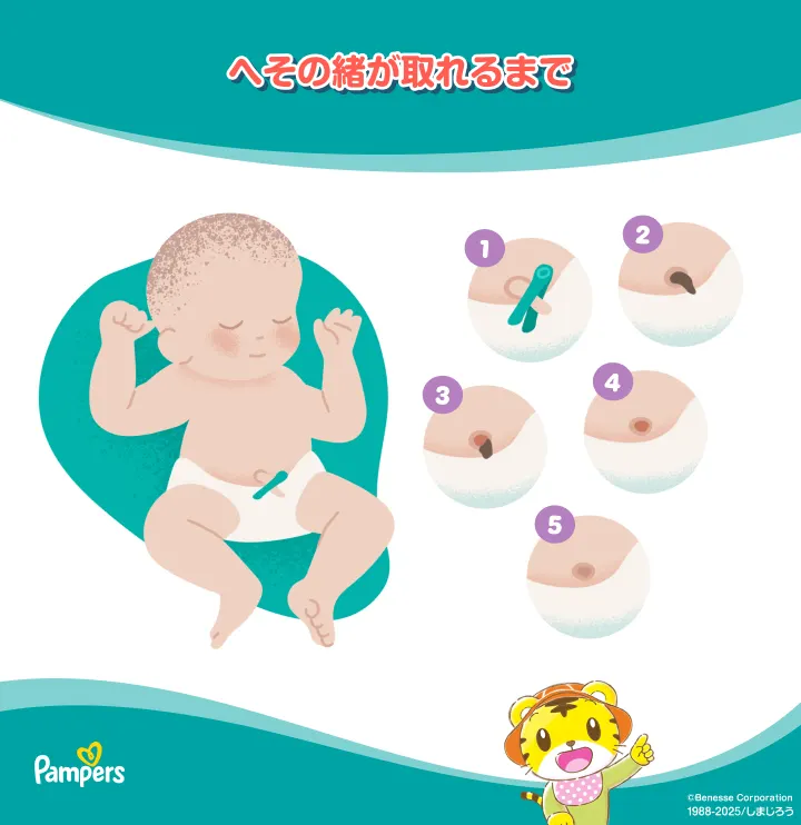 新生児のへその緒が取れるまで