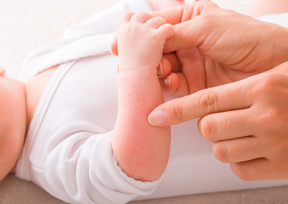 Mamá toca a su bebé. Remedios para la alergia.