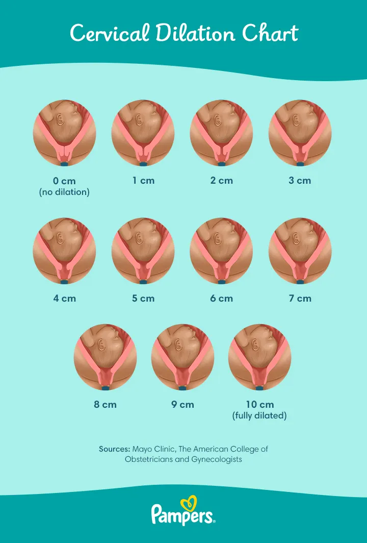 cervical dilation chart