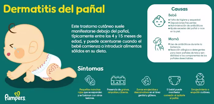 Causas de la dermatitis del pañal