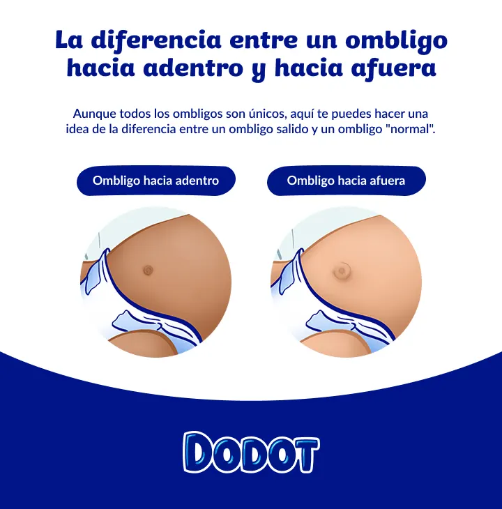 Hernia umbilical bebé fotos Hernia umbilical bebé fotos