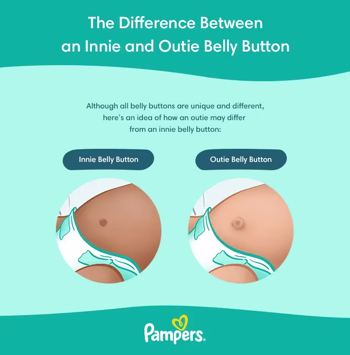Newborn with outie belly button