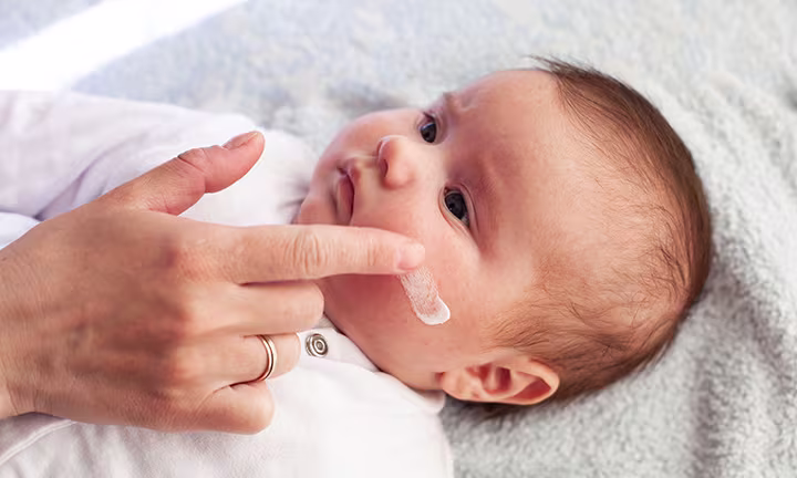 Baby hat trockene Haut im Gesicht,