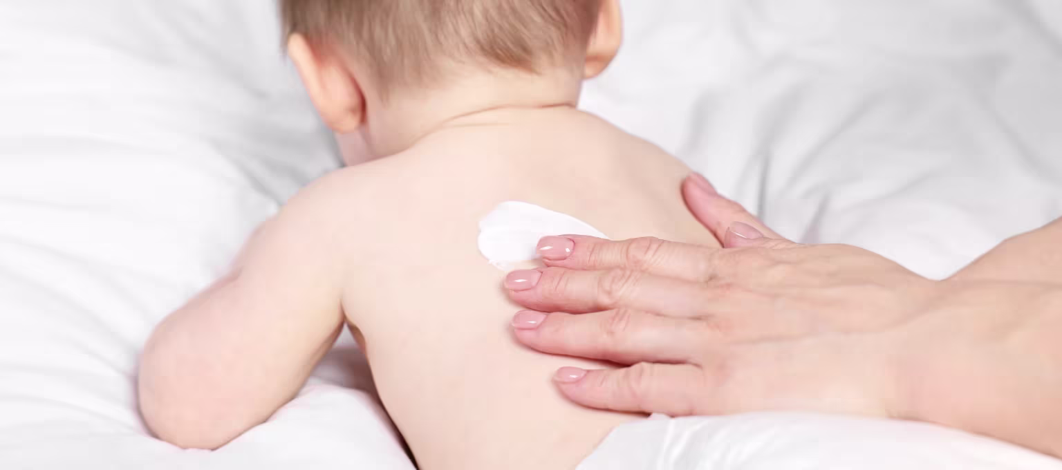 Guagua con sangrado por dermatitis de pañal