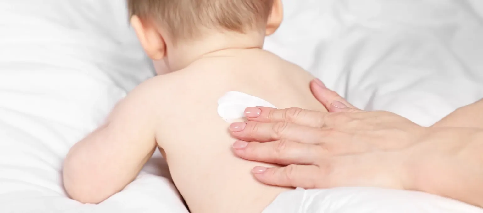 Bebé con sangrado por dermatitis de pañal