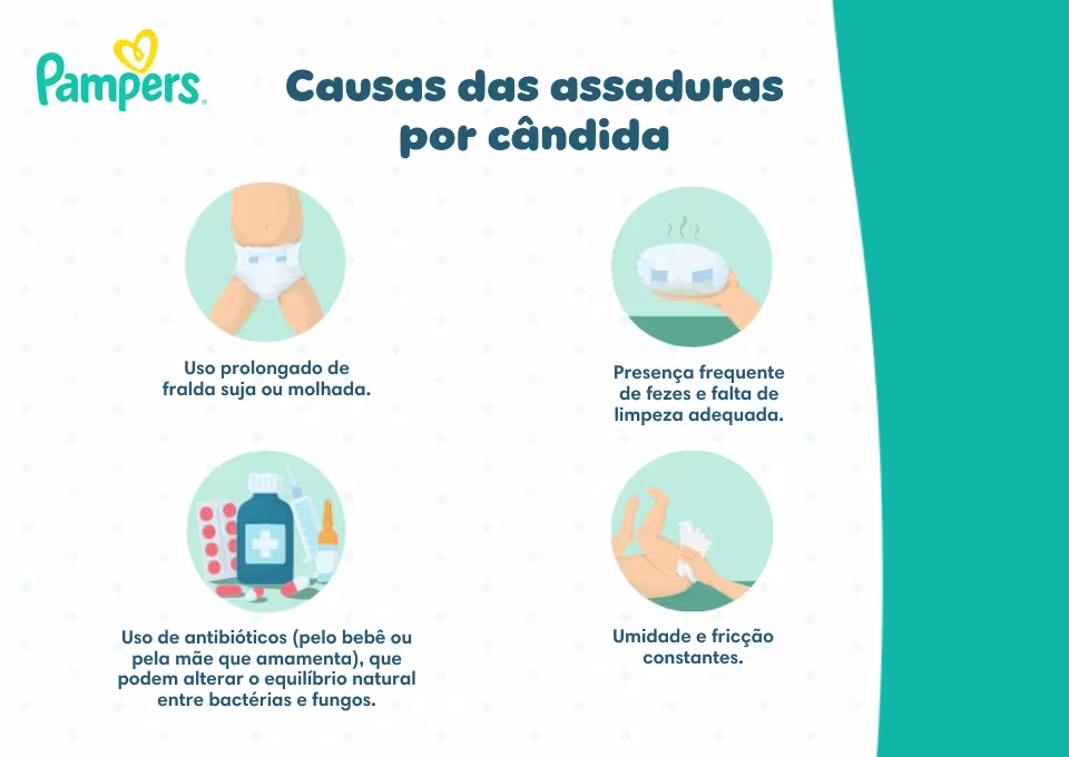 Causas das assaduras por cândida