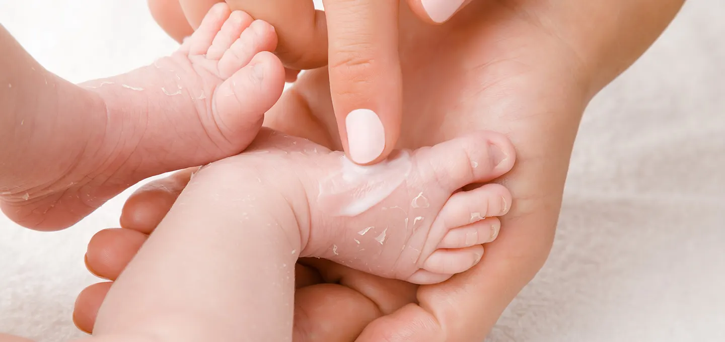 Dry, Peeling Skin in Newborns and Older Babies