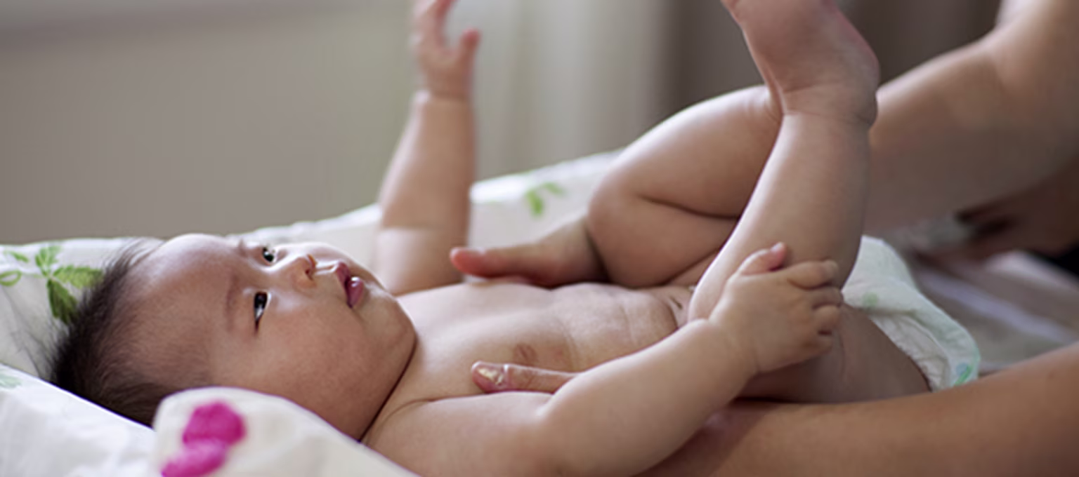 Bebé con dermatitis del pañal