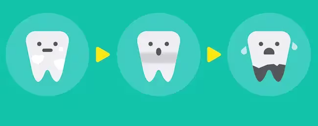 A Healthy Routine to Prevent Baby Tooth Decay