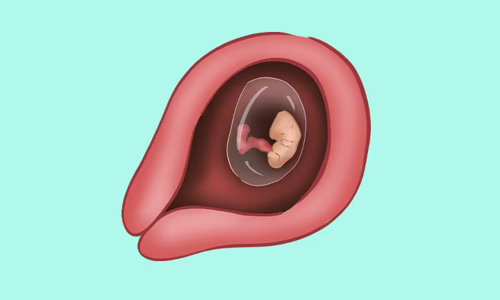 Embryolage in der 6. SSW