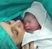 Caesarean Section: Mother and baby after delivery
