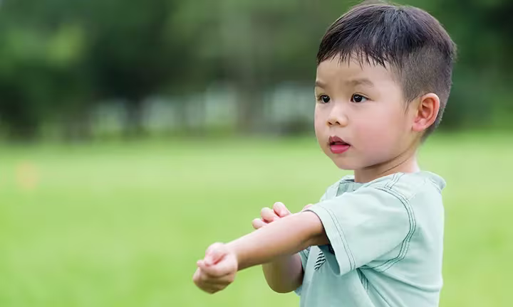 Mosquito bites on babies