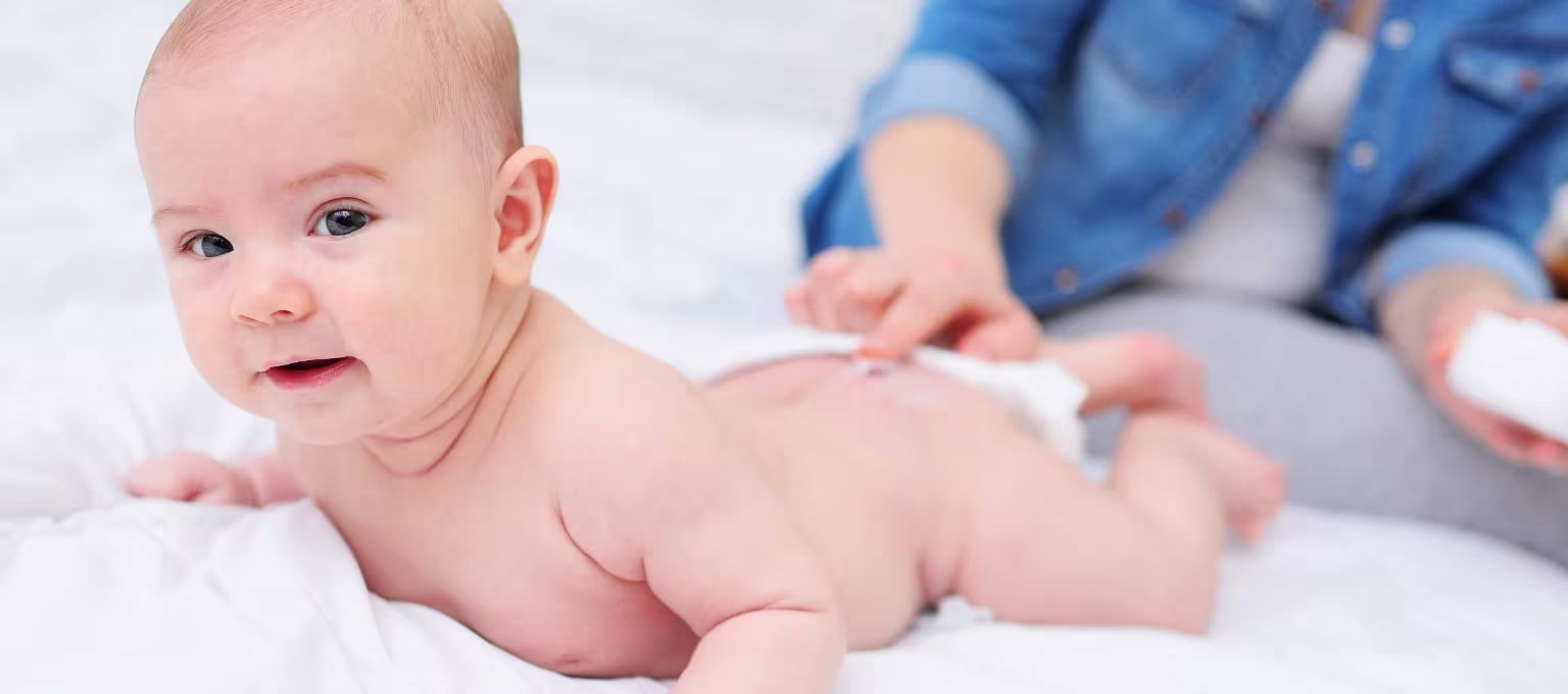 Bebê con dermatite da fralda