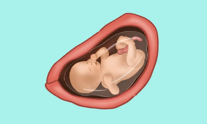 baby at 31 weeks pregnant baby at 31 weeks pregnant