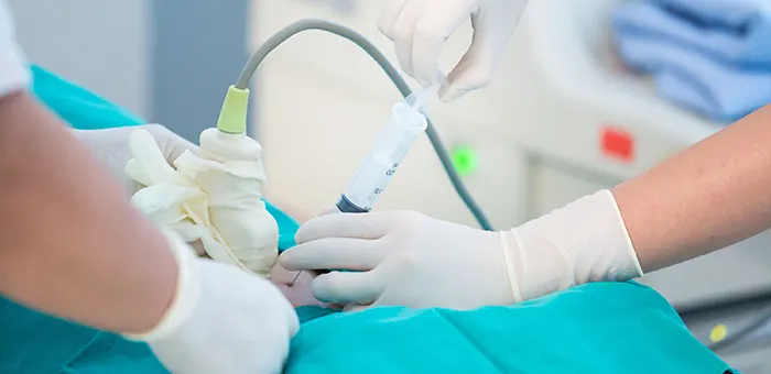 Procedimiento de amniocentesis 