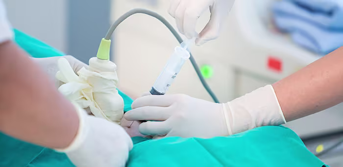 Amniocentesis procedure