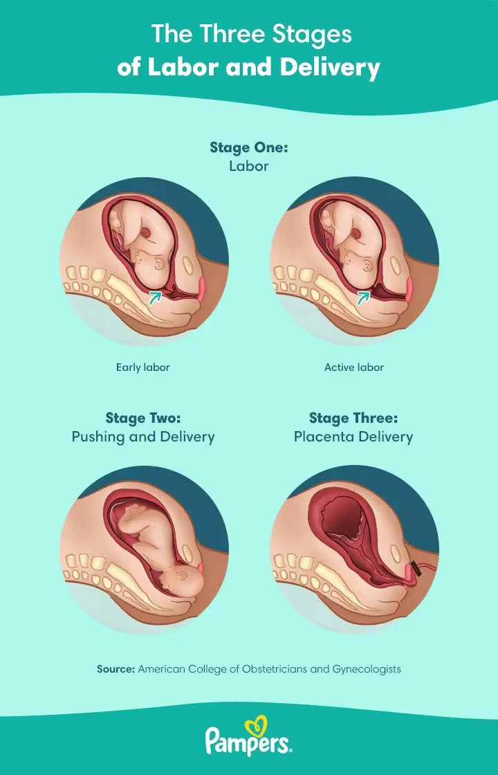 Stages of Labor