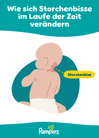 Kinderimpfung: Impfkalender fr Babys & Kleinkinder | Pampers
