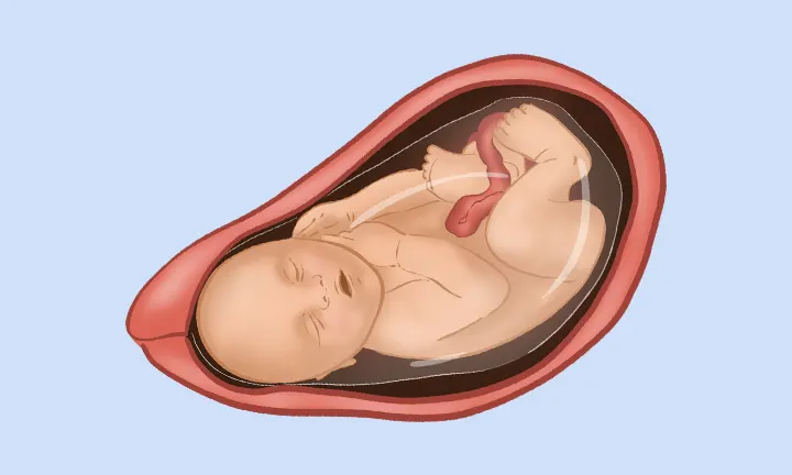 Feto en la semana 40 de embarazo Feto en la semana 40 de embarazo