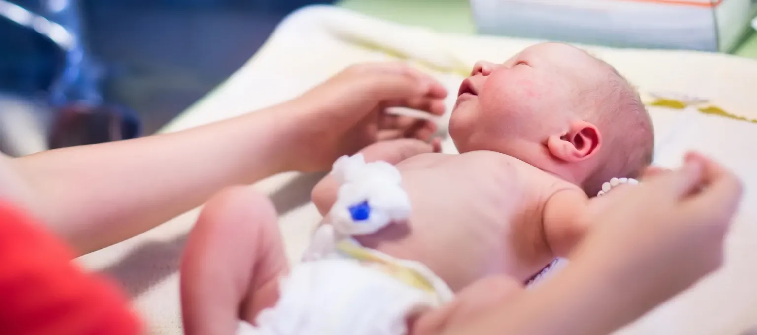 Mamá cambiando pañal a su bebé prematuro Mamá cambiando pañal a su bebé prematuro