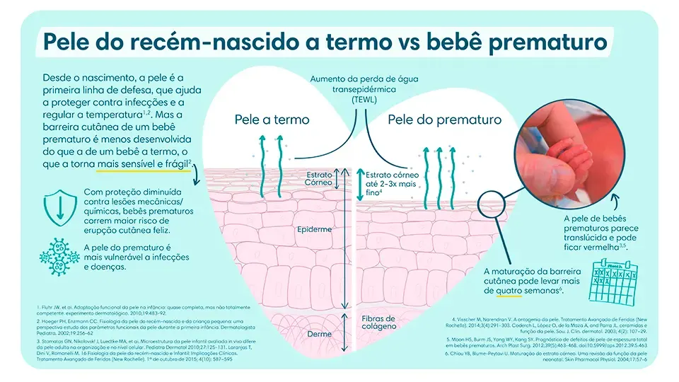 Pele do recém-nascido a termo vs bebê prematuro | Pampers® Brasil Pele de um bebê recém-nascido vs Pele de um bebê prematuro