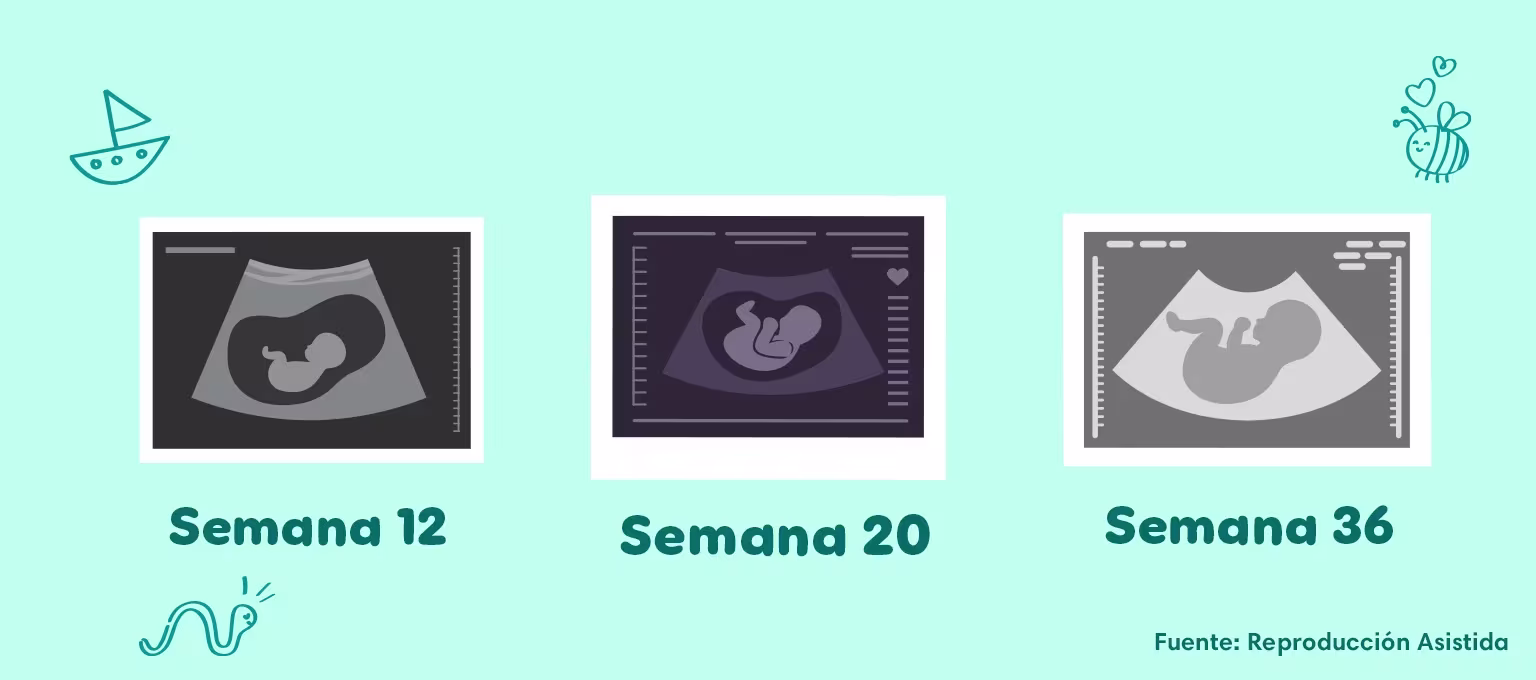 Ecografía en el embarazo