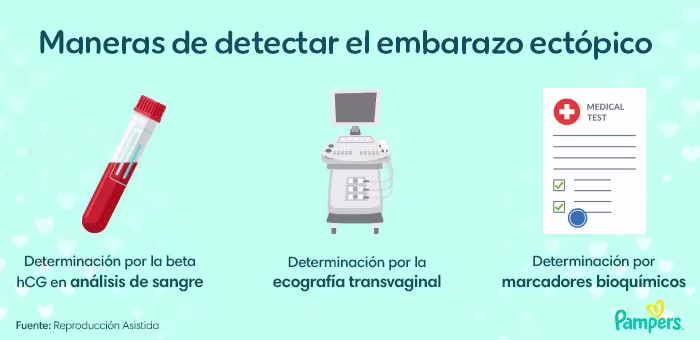 embarazo ectópico