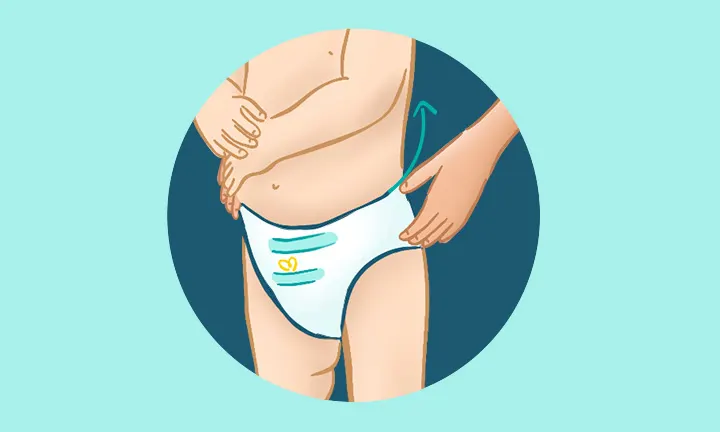 パンツテープ交換 2