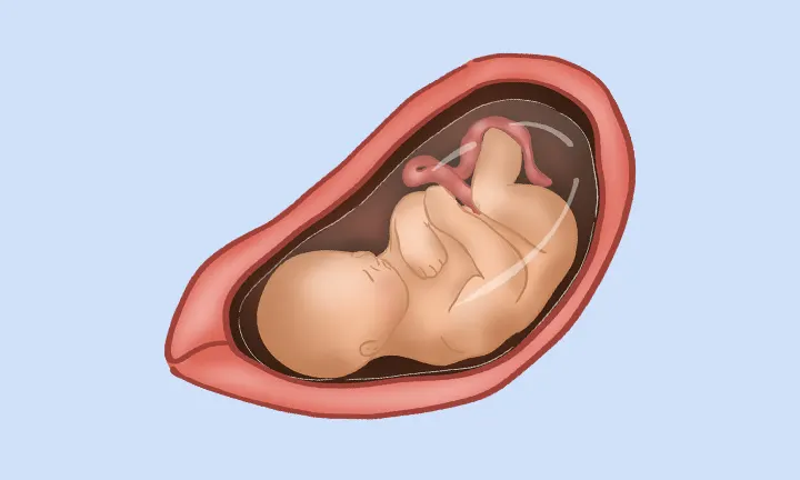 Feto en la semana 33 de embarazo